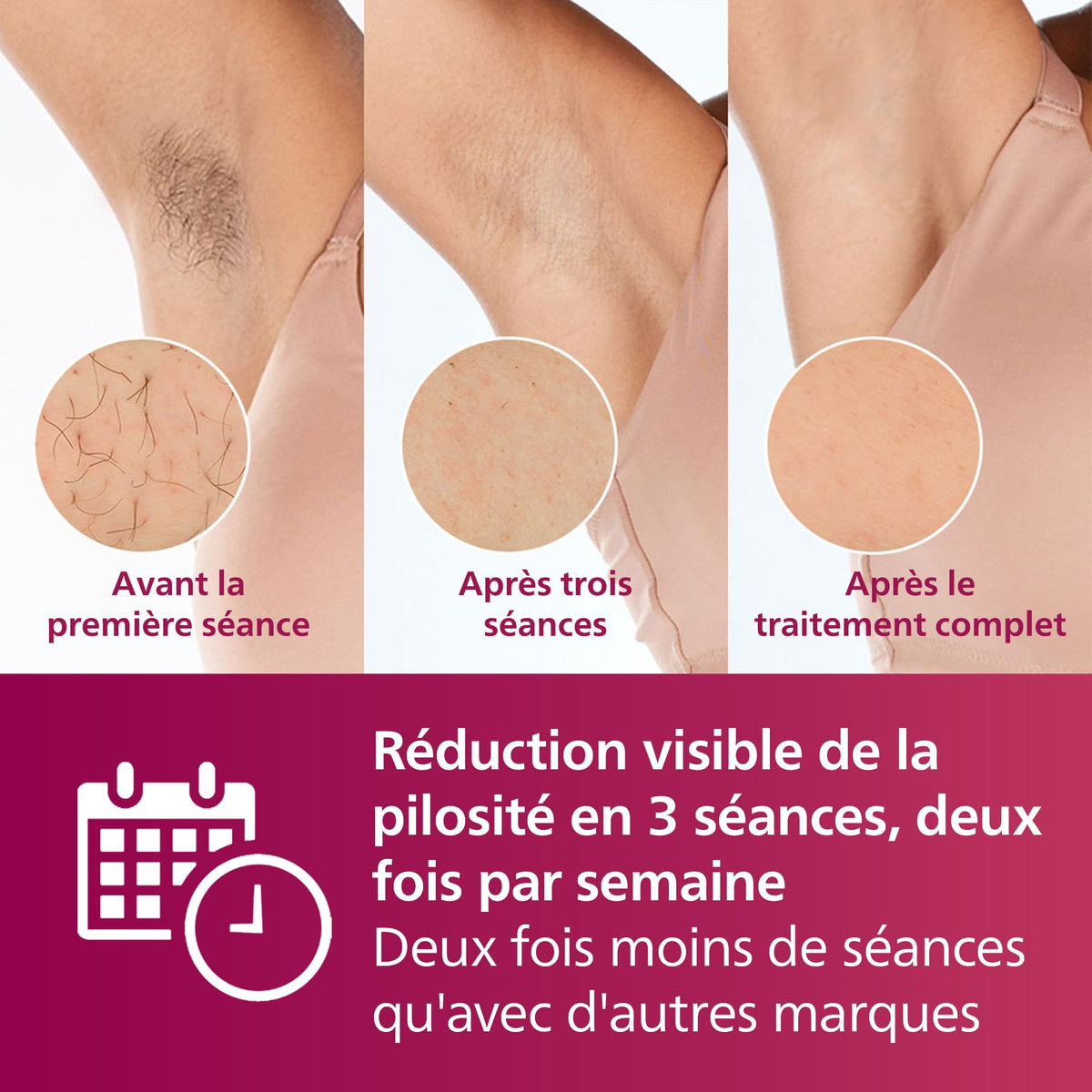 Philips Lumea série 7000, Épilateur à lumière pulsée, alternative à l'épilation laser, 3 embouts pour le corps, le visage et le maillot, modèle SC1999/00