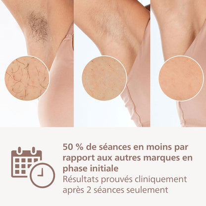 Philips Lumea série 8000 - épilateur à lumière pulsée, alternative à l'épilation laser, technologie SenseIQ, 3 embouts pour le corps, le visage et les zones de précision, BRI946/00