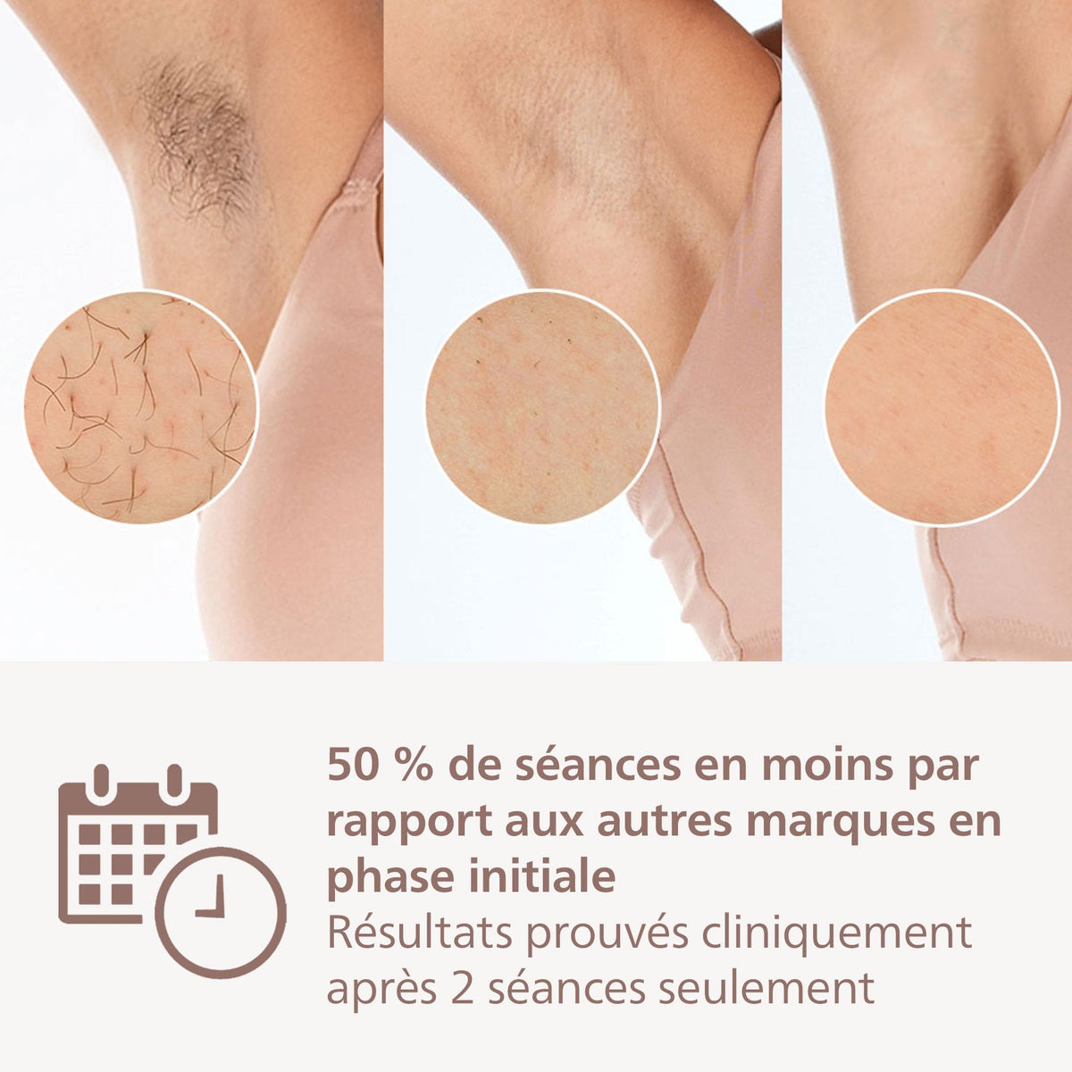 Philips Lumea série 8000, Épilateur à lumière pulsée, alternative à l'épilation laser, technologie SenseIQ, 4 accessoires pour le corps, le visage, le maillot et les aisselles, modèle BRI948/00